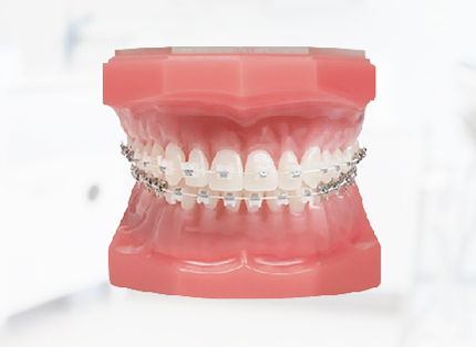 클리피씨 치아교정